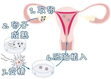 显微操作